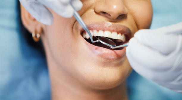 Best Emergency Dental Care for Sports Injuries in Willow Springs, MO